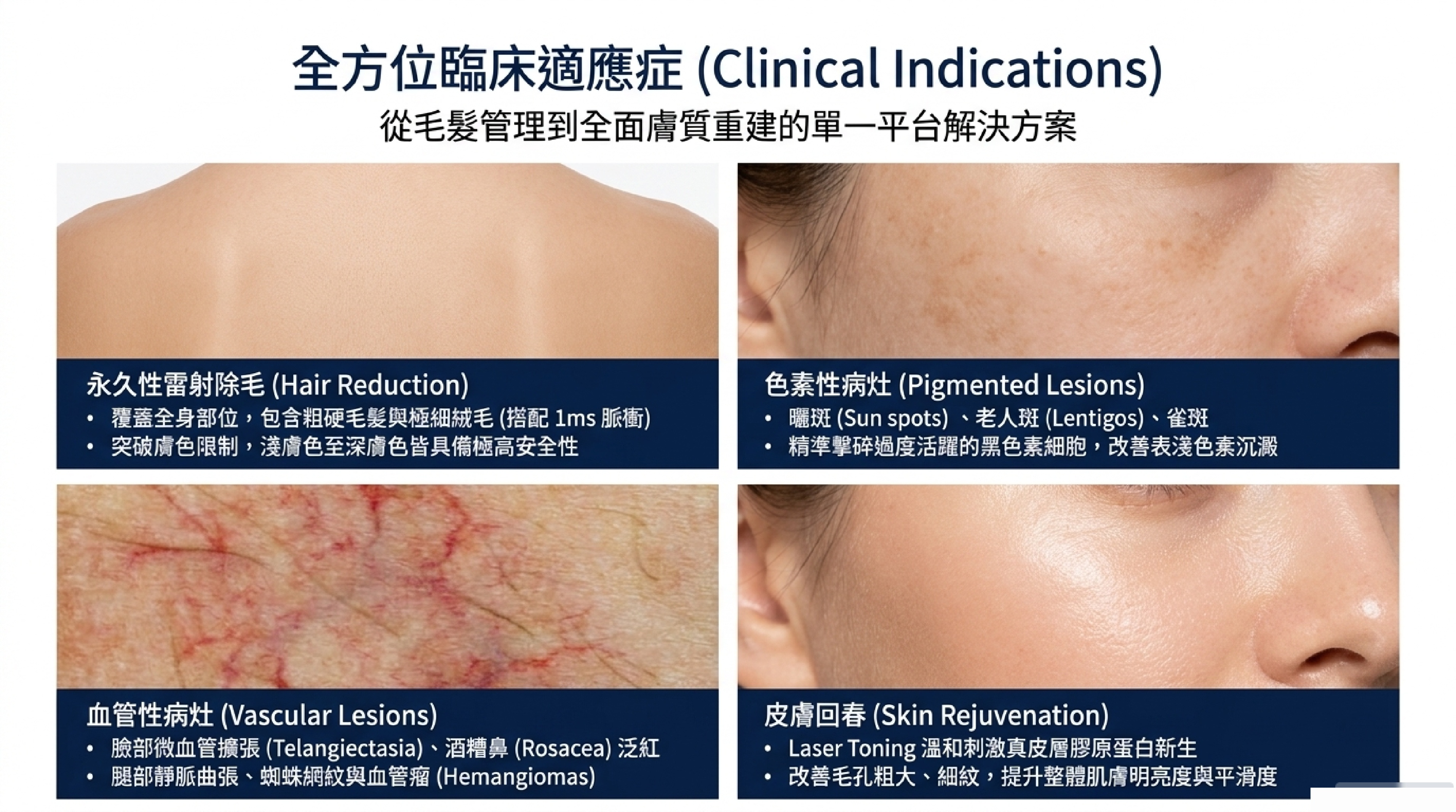Clarity II 全方位臨床適應症：除毛、淨斑、血管病灶、皮膚回春