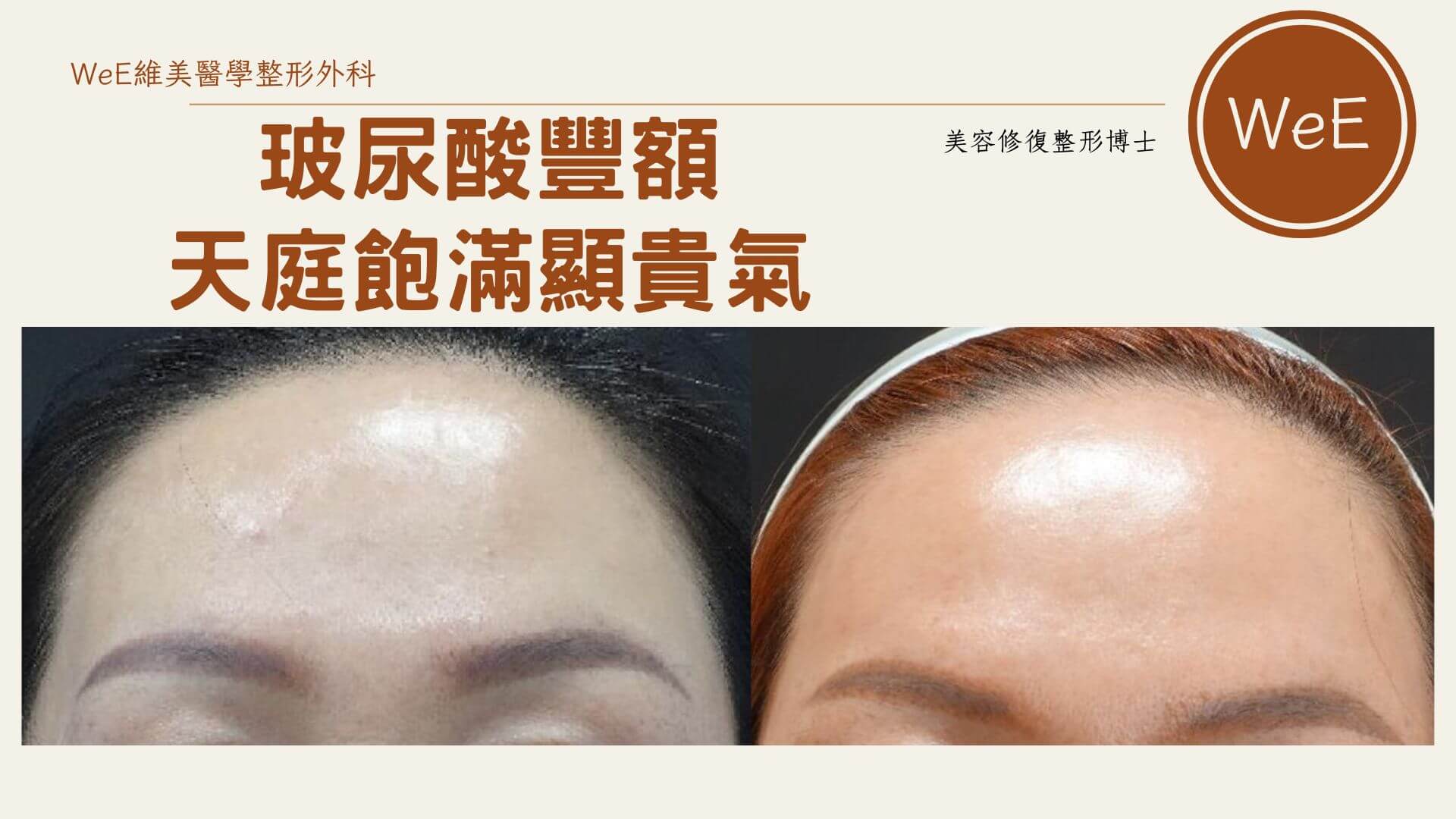 豐額材質與技術考量