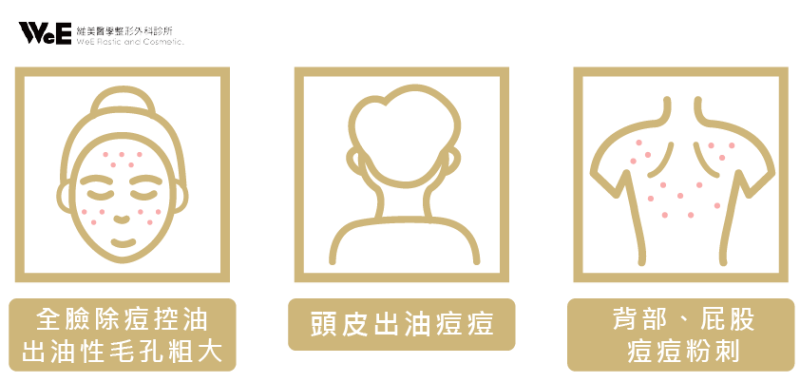 CAPRI 藍雷射適合對象說明