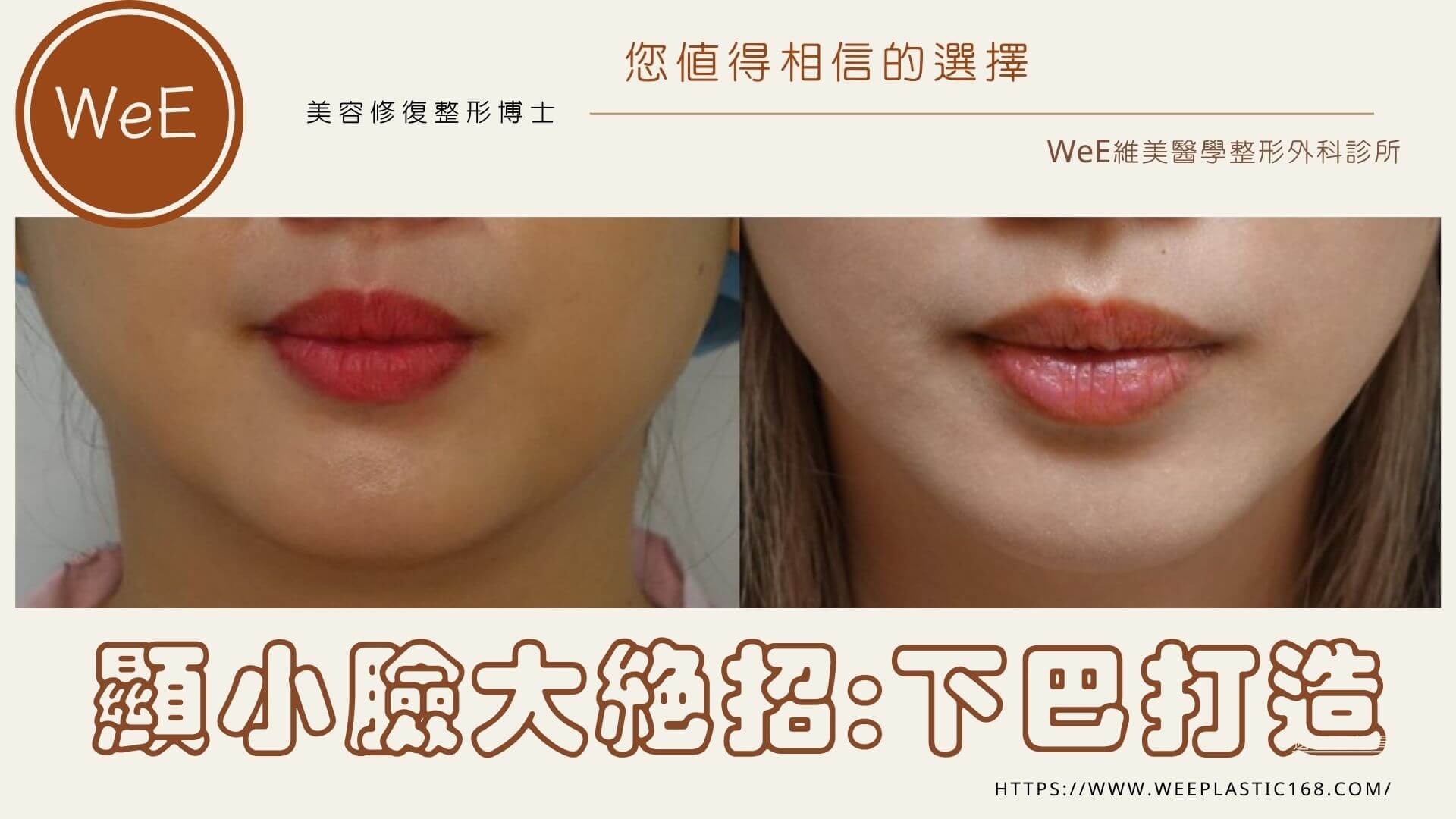 下巴 V 臉 — 黃金 V 比例