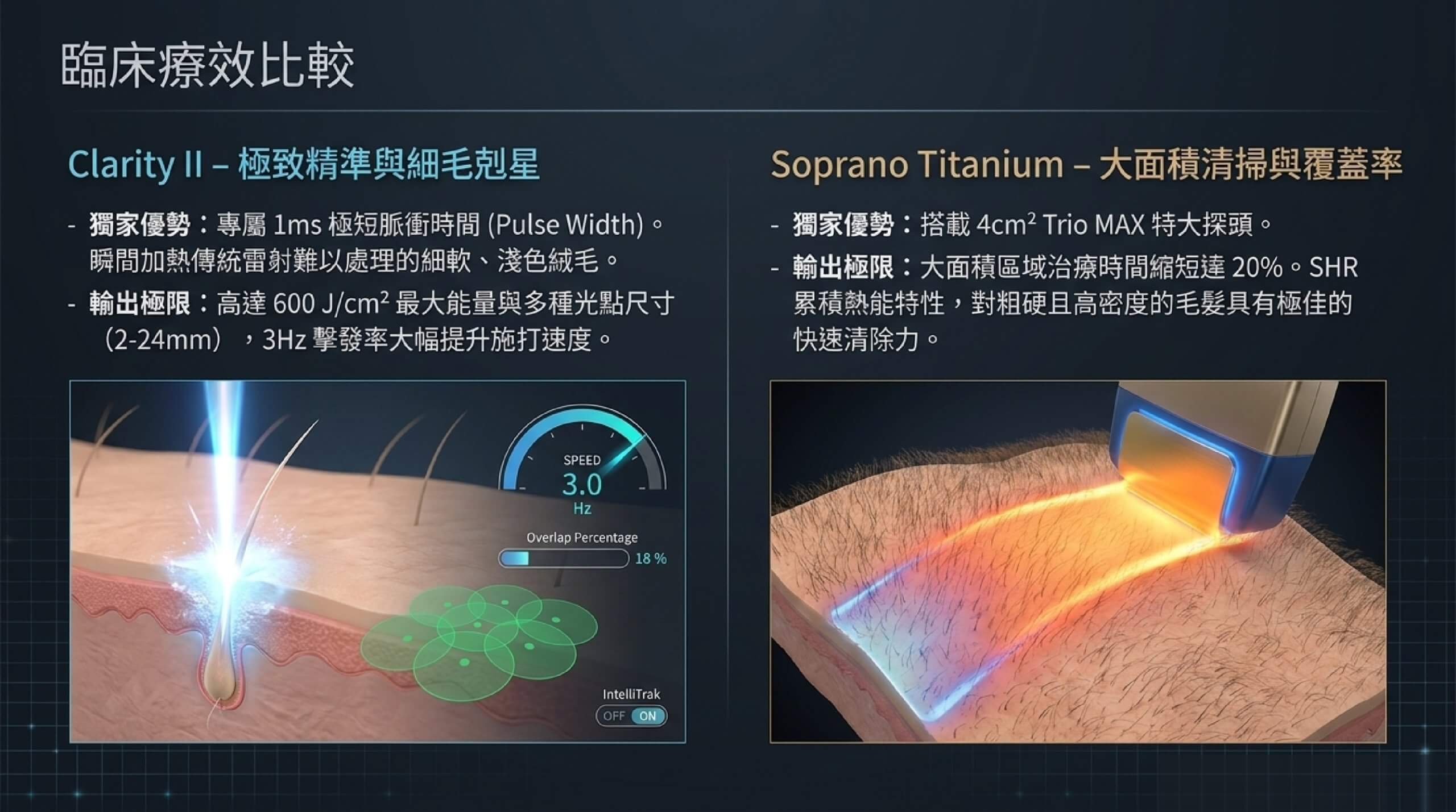 Clarity II 精準細毛剋星與 Soprano Titanium 大面積清掃覆蓋率臨床比較