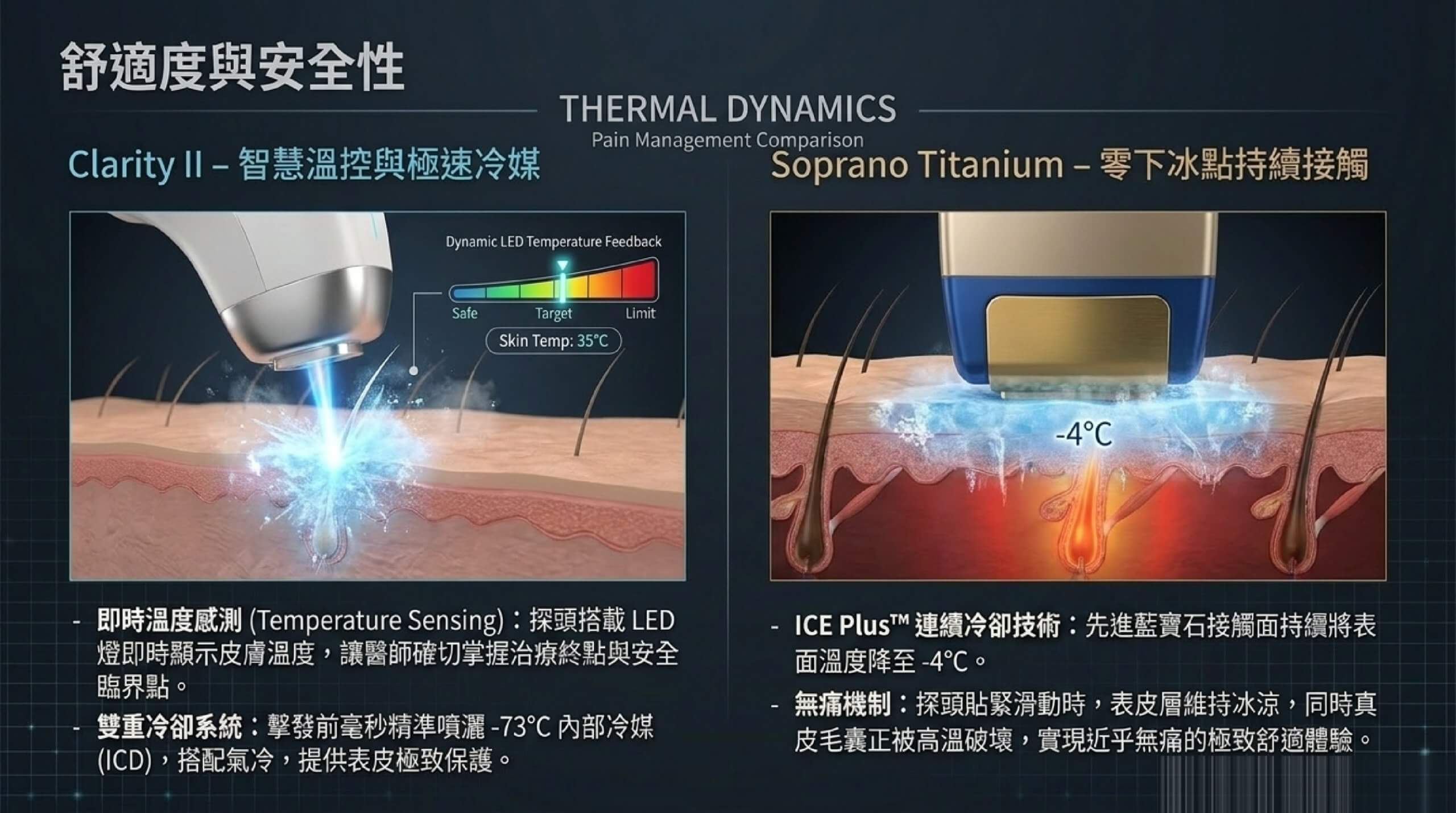 Clarity II 智慧溫控極速冷媒 ICD 與 Soprano Titanium ICE Plus 接觸式冷卻對比