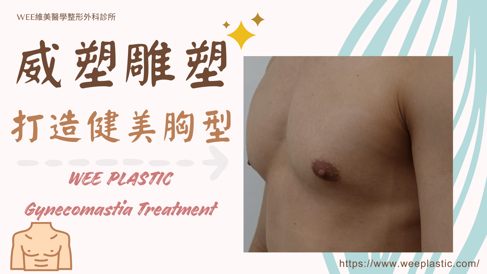男性女乳體雕