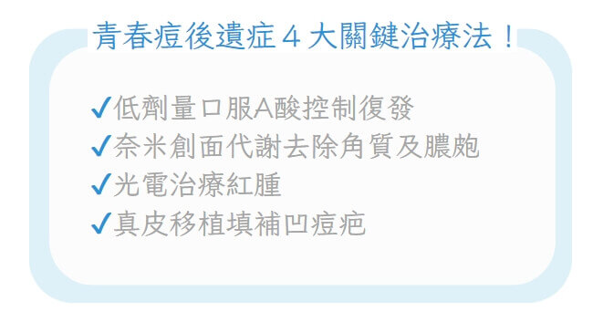 青春痘 4 大關鍵治療法示意圖