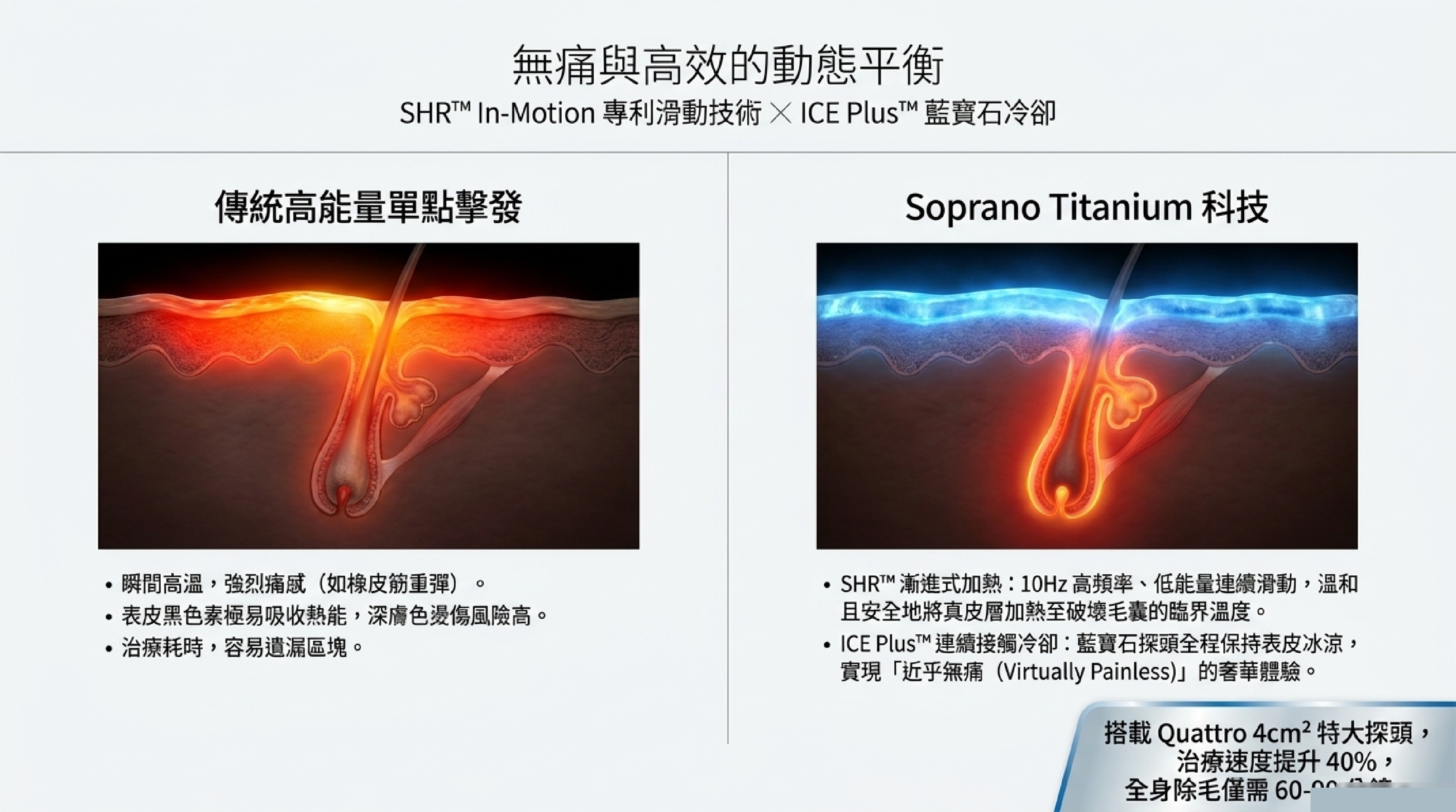 SHR In-Motion 專利滑動技術與 ICE Plus 藍寶石冷卻系統：將傳統高能量單擊轉為近乎無痛的漸進式毛囊破壞
