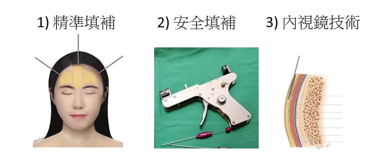 WeE 豐額三大密技示意圖