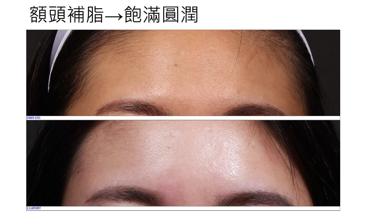 維醫豐額成功案例 1