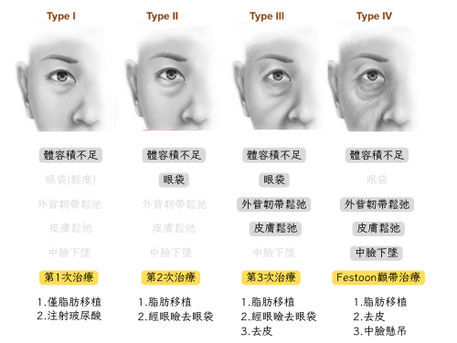 眼袋淚溝臨床分級對照圖