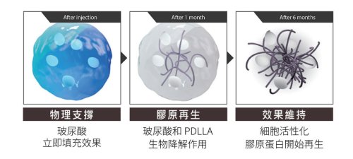 VIVABELLA 薇貝拉 — 二代精靈針